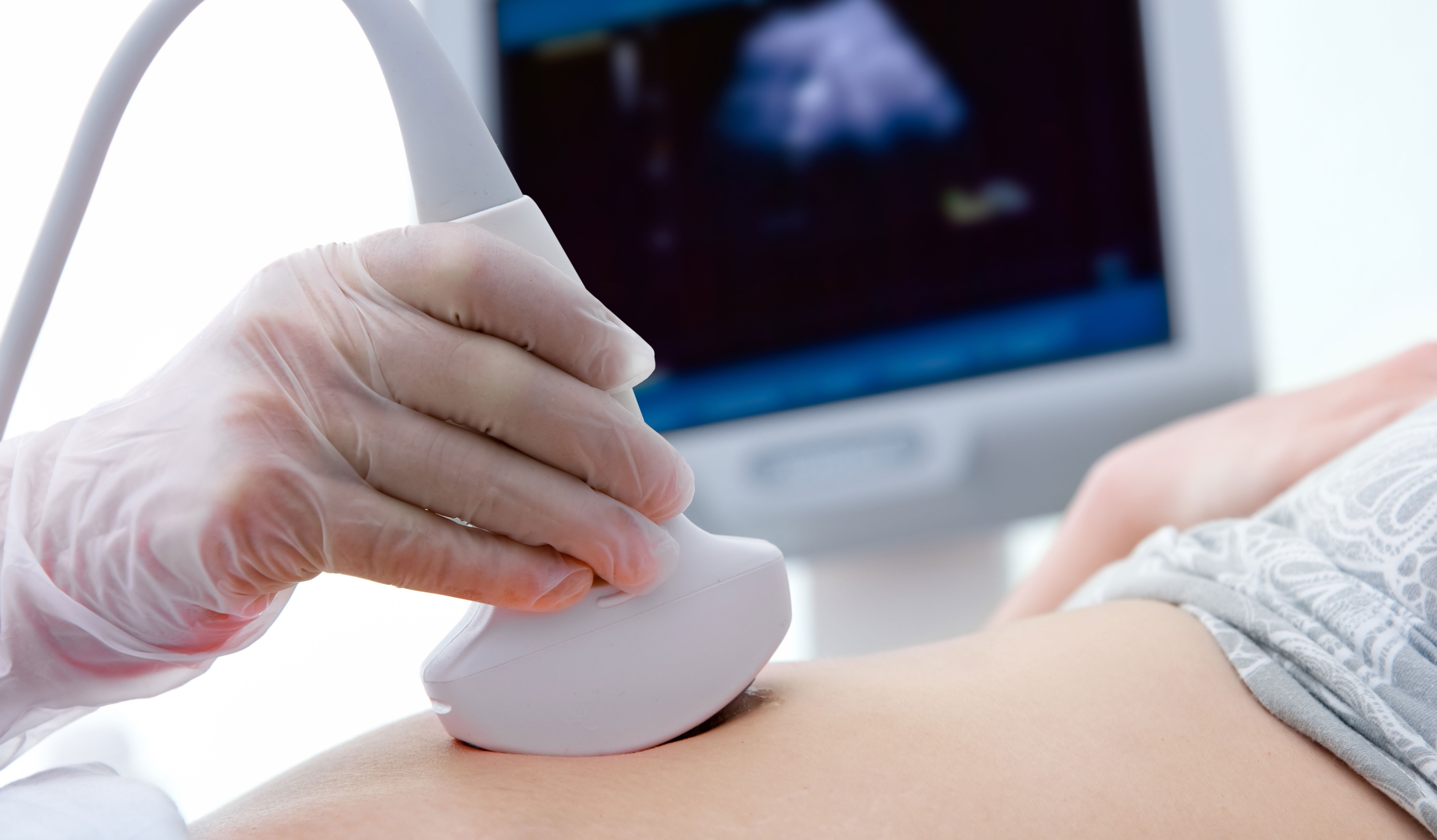 Ultrasound | a member of the PVH Group of companies | owned by Peter Harris Barbados